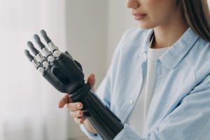 A woman touching prosthetic arm
